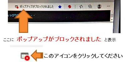 設定画面