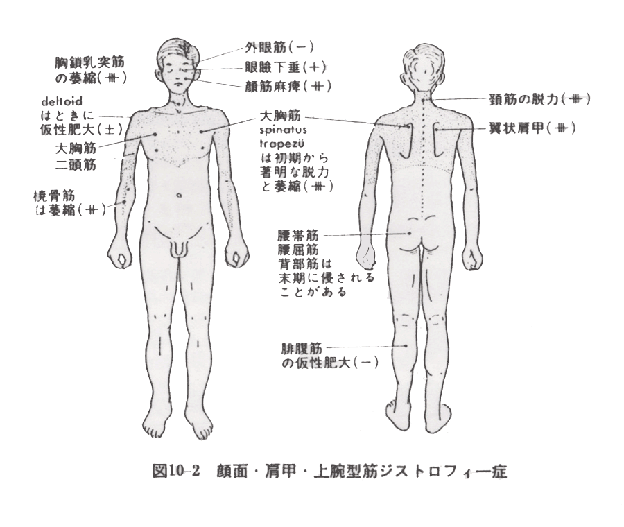 筋ジストロフィー症図3-3