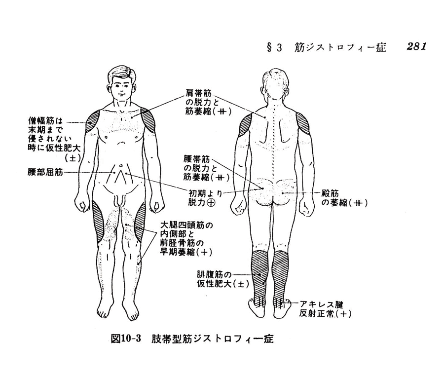 筋ジストロフィー症図3-4-1